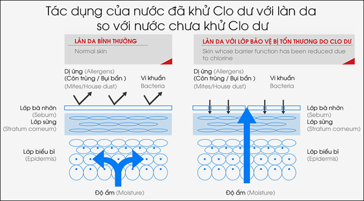 Tia nước vòi sen có thể cải thiện bệnh lý về da