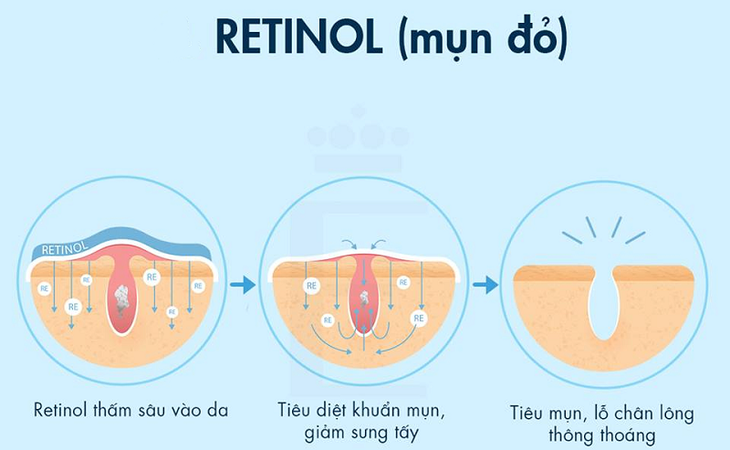 Retinol là gì - Thành phần chống lão hóa, trị mụn và trẻ hóa da